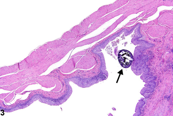 Bladder stone of a rat